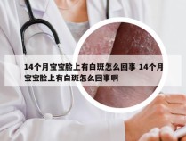 14个月宝宝脸上有白斑怎么回事 14个月宝宝脸上有白斑怎么回事啊