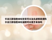卡泊三醇倍他米松软膏可以治头部银屑病吗 卡泊三醇倍他米松凝胶可以用于身体吗