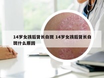 14岁女孩后背长白斑 14岁女孩后背长白斑什么原因
