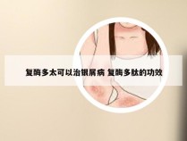 复酶多太可以治银屑病 复酶多肽的功效