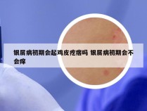 银屑病初期会起鸡皮疙瘩吗 银屑病初期会不会痒