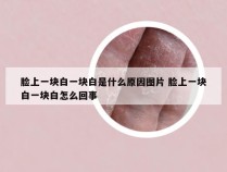 脸上一块白一块白是什么原因图片 脸上一块白一块白怎么回事