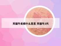 天猫牛皮癣什么意思 天猫牛2代