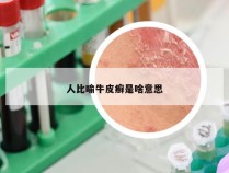 人比喻牛皮癣是啥意思