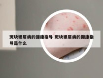 斑块银屑病的健康指导 斑块银屑病的健康指导是什么