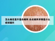怎么确定是不是白癜风 白点癫风早期是什么症状图片