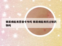 银屑病能用恩替卡韦吗 银屑病能用抗过敏药物吗
