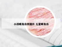 小孩眼角白斑图片 儿童眼角白