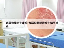 大蒜熬醋治牛皮癣 大蒜配醋能治疗牛结节病吗
