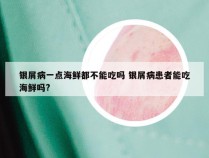 银屑病一点海鲜都不能吃吗 银屑病患者能吃海鲜吗?