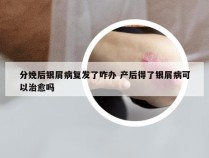 分娩后银屑病复发了咋办 产后得了银屑病可以治愈吗