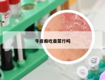牛皮癣吃韭菜行吗