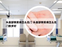 头面部银屑病怎么出门 头面部银屑病怎么出门散步好