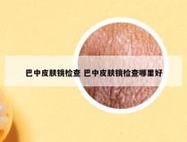 巴中皮肤镜检查 巴中皮肤镜检查哪里好