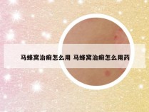 马蜂窝治癣怎么用 马蜂窝治癣怎么用药