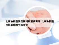 北京协和医院皮肤科银屑病专家 北京协和医院银屑病哪个医生好