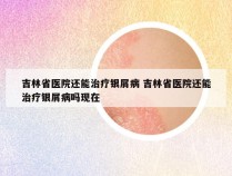 吉林省医院还能治疗银屑病 吉林省医院还能治疗银屑病吗现在