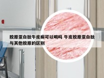 胶原蛋白肽牛皮癣可以喝吗 牛皮胶原蛋白肽与其他胶原的区别