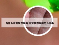 为什么手臂突然长癣 手臂突然长癣怎么回事