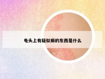 龟头上有疑似癣的东西是什么