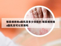 银屑病用微a酸乳膏多少浓度的 银屑病用维a酸乳膏可以常用吗