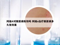 阿维A对银屑病有效吗 阿维a治疗银屑病多久有效果