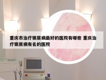 重庆市治疗银屑病最好的医院有哪些 重庆治疗银屑病有名的医院