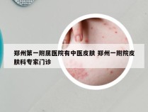 郑州第一附属医院有中医皮肤 郑州一附院皮肤科专家门诊