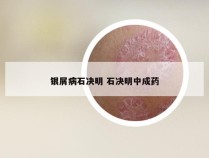 银屑病石决明 石决明中成药
