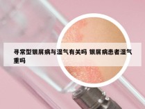 寻常型银屑病与湿气有关吗 银屑病患者湿气重吗