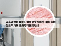 山东省桓台县华沟银屑病专科医院 山东省桓台县华沟银屑病专科医院地址