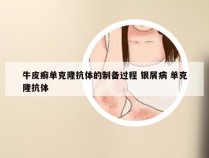 牛皮癣单克隆抗体的制备过程 银屑病 单克隆抗体