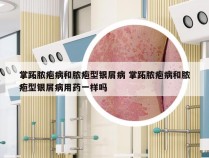 掌跖脓疱病和脓疱型银屑病 掌跖脓疱病和脓疱型银屑病用药一样吗