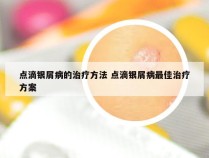 点滴银屑病的治疗方法 点滴银屑病最佳治疗方案