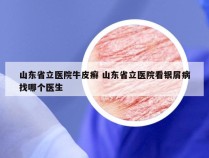 山东省立医院牛皮癣 山东省立医院看银屑病找哪个医生