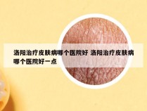 洛阳治疗皮肤病哪个医院好 洛阳治疗皮肤病哪个医院好一点