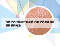 六种中药泡澡治疗银屑病 六种中药泡澡治疗银屑病的方法