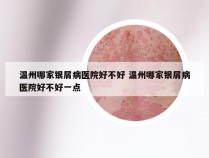 温州哪家银屑病医院好不好 温州哪家银屑病医院好不好一点