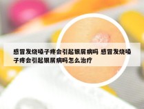 感冒发烧嗓子疼会引起银屑病吗 感冒发烧嗓子疼会引起银屑病吗怎么治疗