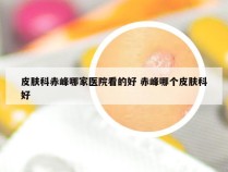 皮肤科赤峰哪家医院看的好 赤峰哪个皮肤科好