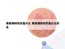 银屑病特效药是什么 银屑病特效药是什么药名