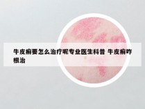 牛皮癣要怎么治疗呢专业医生科普 牛皮癣咋根治