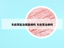 车前草能治银翘病吗 车前草治癣吗