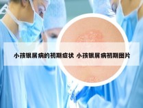 小孩银屑病的初期症状 小孩银屑病初期图片