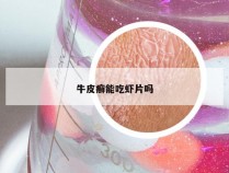 牛皮癣能吃虾片吗