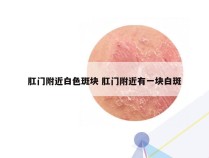 肛门附近白色斑块 肛门附近有一块白斑