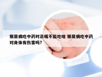 银屑病吃中药时忌嘴不能吃啥 银屑病吃中药对身体有伤害吗?