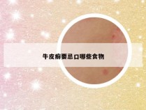 牛皮癣要忌口哪些食物
