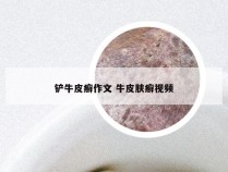 铲牛皮癣作文 牛皮肤癣视频