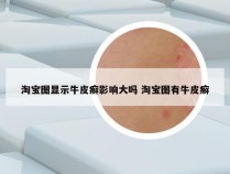 淘宝图显示牛皮癣影响大吗 淘宝图有牛皮癣